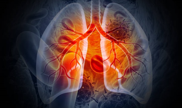 tuberculosis specialist surgeon best tuberculosis specialist surgeon in vashi